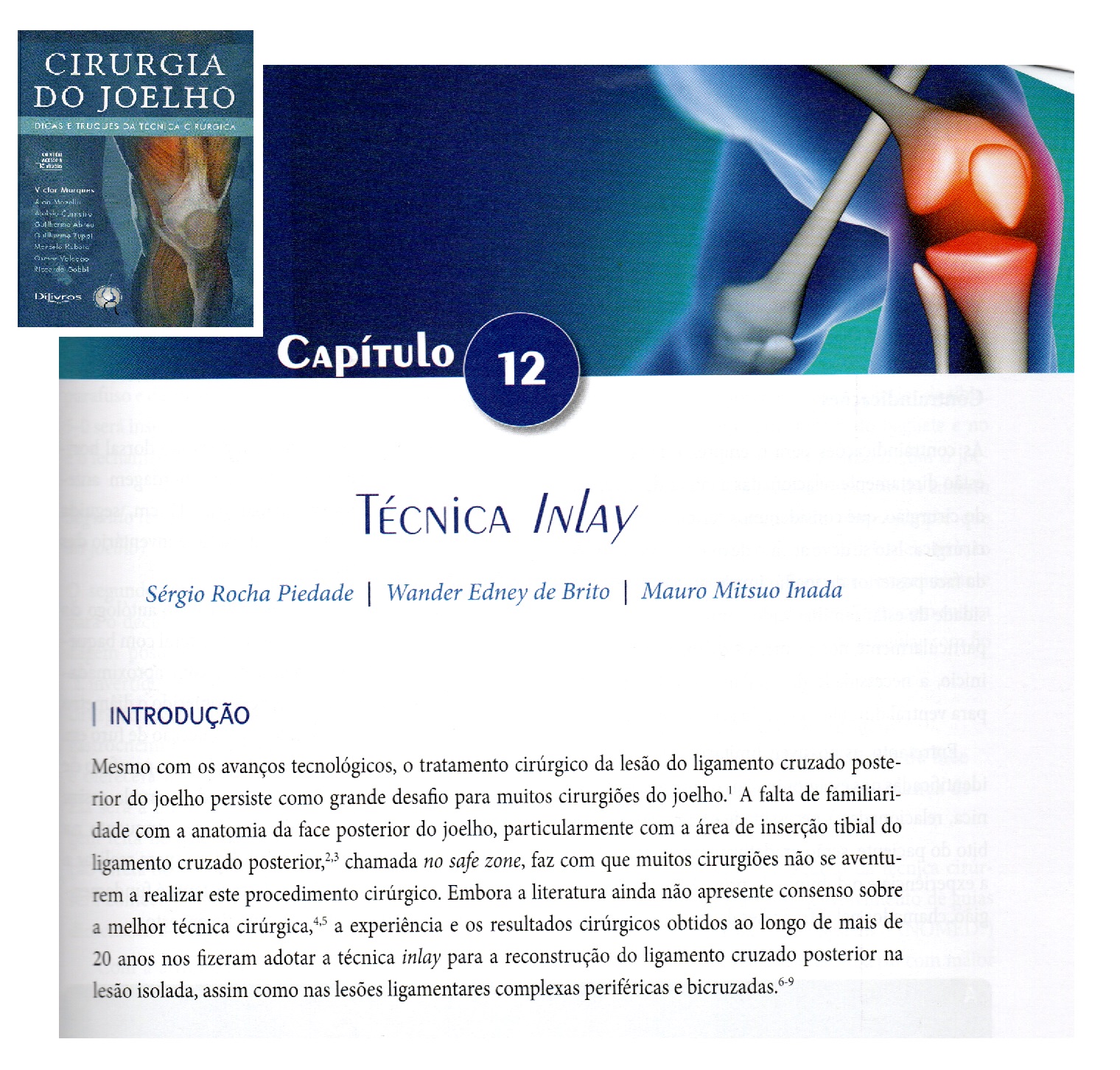 tecnica inlay