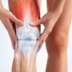 Tipos de Cirurgias de Reconstrução Ligamentar do Joelho - Prof. Dr. Sérgio Piedade Artroplastia Patelofemoral