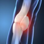 Envelhecimento e a Medicina do Esporte - Prof. Dr. Sérgio Piedade Cirurgia LCA: Reconstrução Ligamento Cruzado Anterior