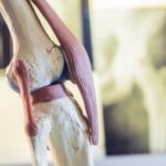 Envelhecimento e a Medicina do Esporte - Prof. Dr. Sérgio Piedade Cirurgia de Reconstrução do Ligamento Bicruzado do Joelho