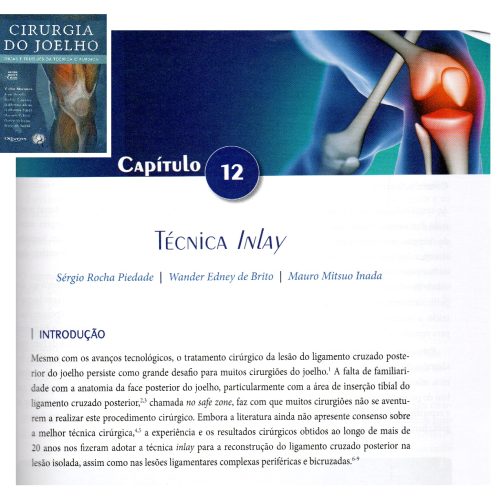 Tecnica inlay