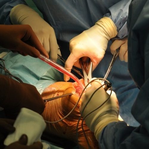 Cirurgia de Reconstrução Multiligamentar do Joelho